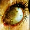 Vision