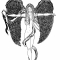 Angel1