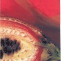 Ovary by Eva  Fidjeland