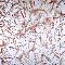 Sanguinary Abstraction