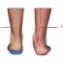  pelvic floor therapy by Body Med