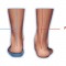 pelvic floor therapy