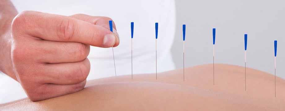 Acupuncture Therapy - 
