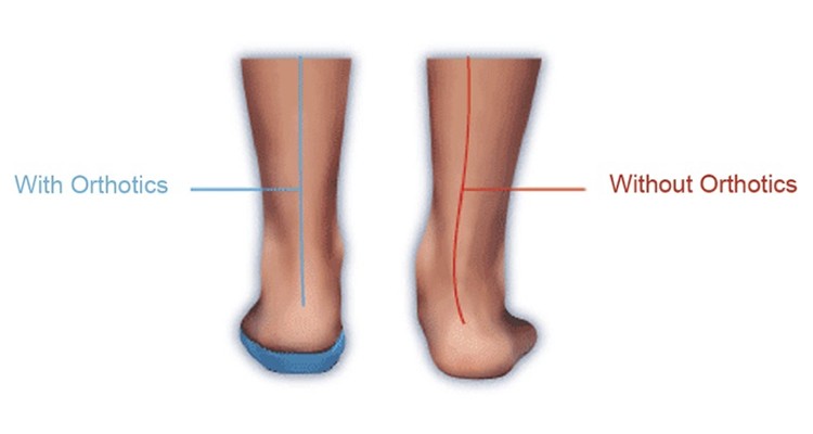 Pelvic Floor Therapy - 