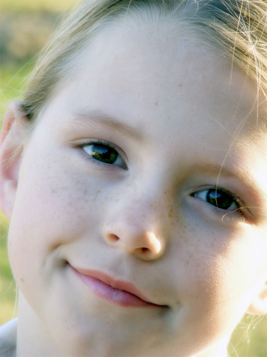 Freckles - 